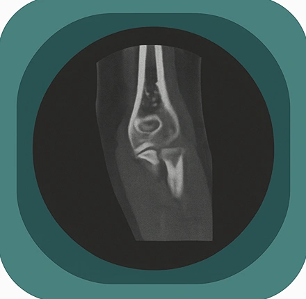 CT elbow anatomy icon-1